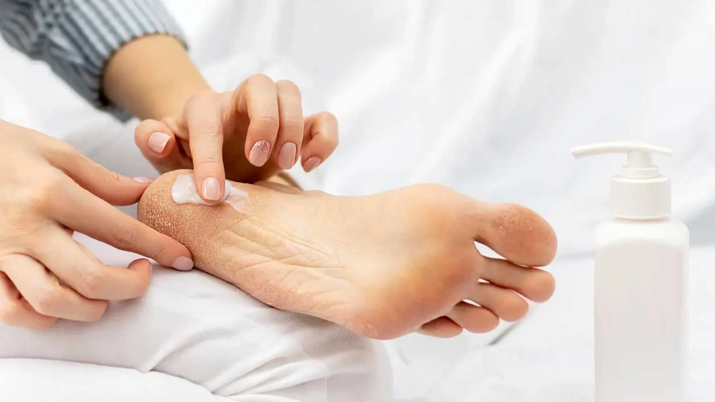 با «موز» کرم پاشنه پا خونگی درست کن+ ویدئو