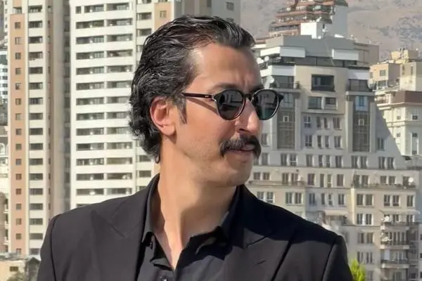 عکس شوکه کننده از بهرام افشاری / چهره ای که زیر و رو شد !