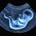 خانم‌های باردار مواظب این کیسه حیاتی باشند