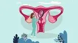 عکس رنگی رحم، دلایل تجویز