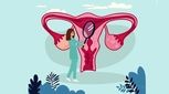 عکس رنگی رحم، دلایل تجویز