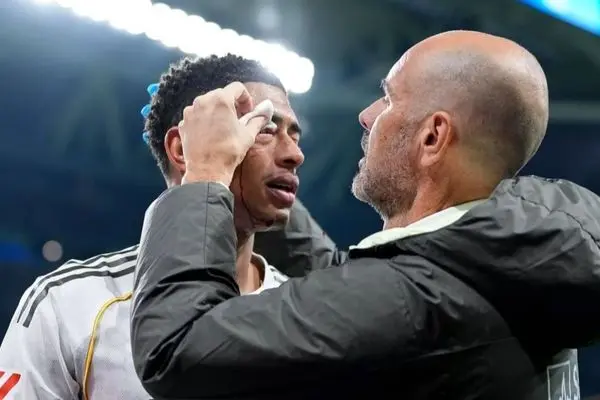 چهره این ستاره رئال مادرید را خونین کردند (عکس)