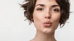 ۱۰ روش عالی برای افزایش حجم لب بدون  تزریق ژل