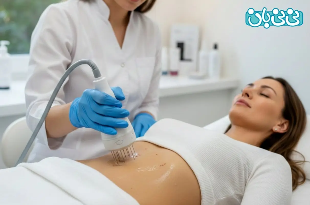 لاغری با مزوتراپی؛ روشی ساده‌تر نسبت به جراحی برای کاهش چربی‌های موضعی