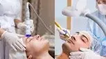اگر تصمیم به لیزر پوست‌تان دارید قبلش این مطلب را بخوانید 