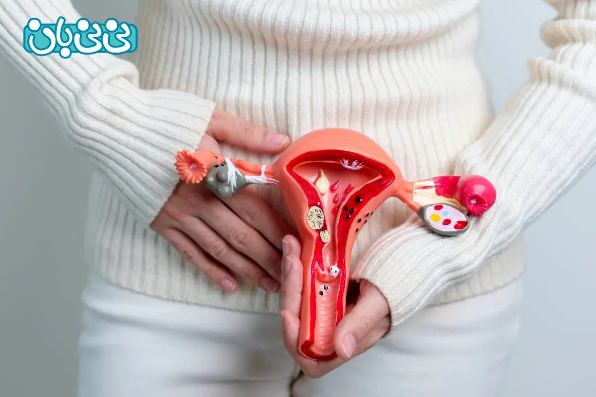 بعد از پاره شدن کیست تخمدان چه باید کرد؟ 6 علائم و درمان