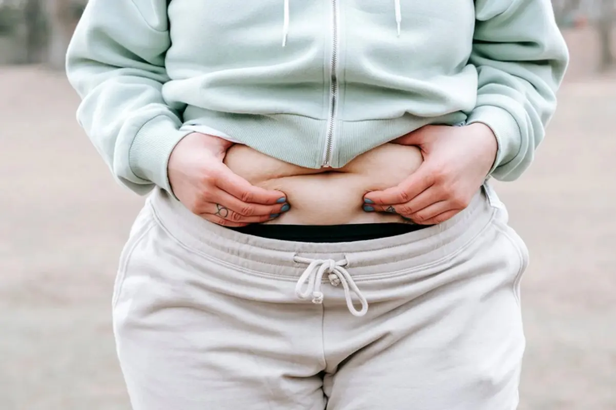 مزایا و معایب ابدومینوپلاستی، قبل از عمل بخوانید!