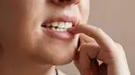 تیک عصبی چیست، چرا به وجود می‌آید و چگونه برطرف می‌شود؟