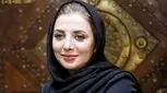 تغییر چهره باورنکردنی رویا میرعلمی/ کوبیده از نو ساخته+ عکس