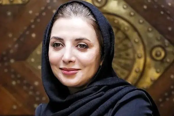 تغییر چهره باورنکردنی رویا میرعلمی/ کوبیده از نو ساخته+ عکس