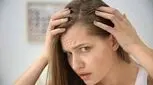 چرا موی جلوی سر خانم‌ها می‌ریزد؟

