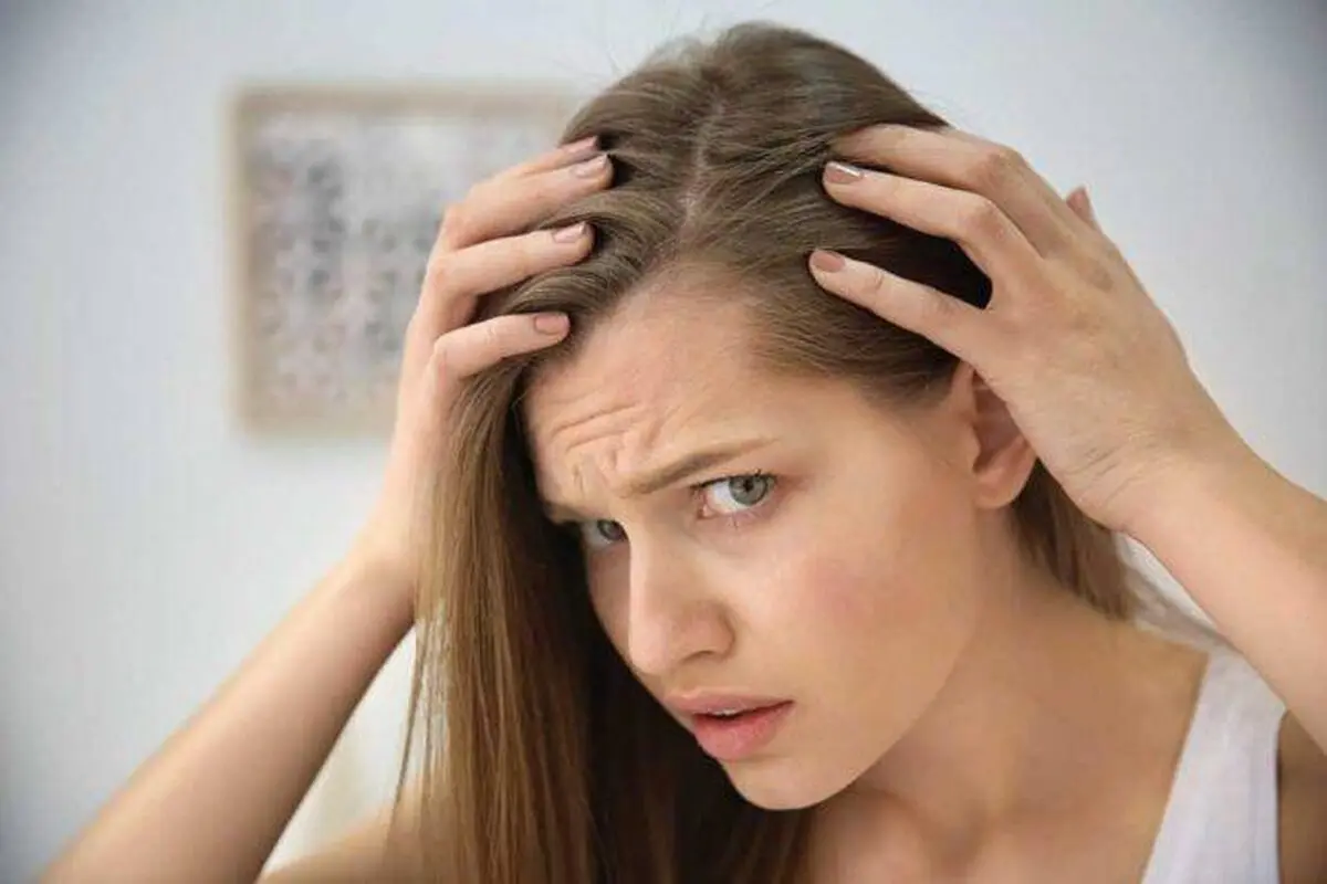 چرا موی جلوی سر خانم‌ها می‌ریزد؟

