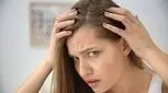 چرا موی جلوی سر خانم‌ها می‌ریزد؟

