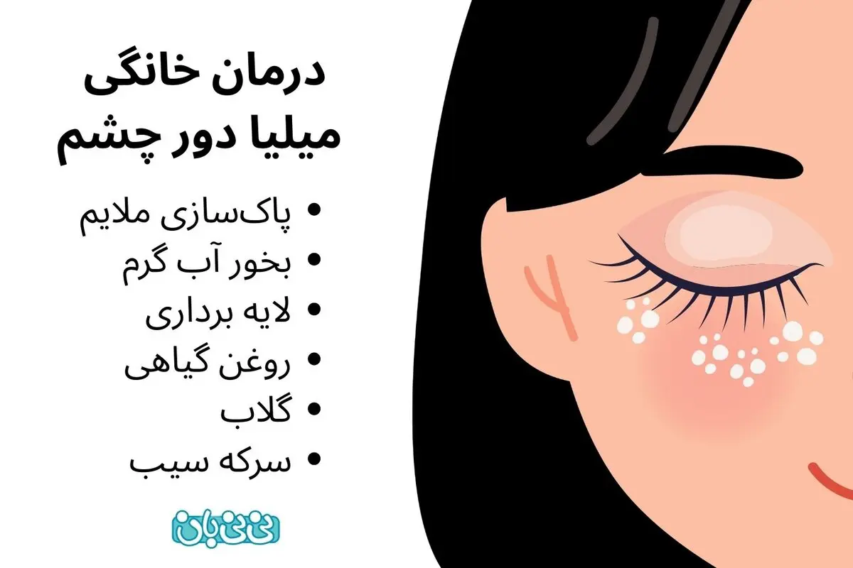 درمان خانگی میلیا دور چشم به 10 روش ساده _ علل، علائم 