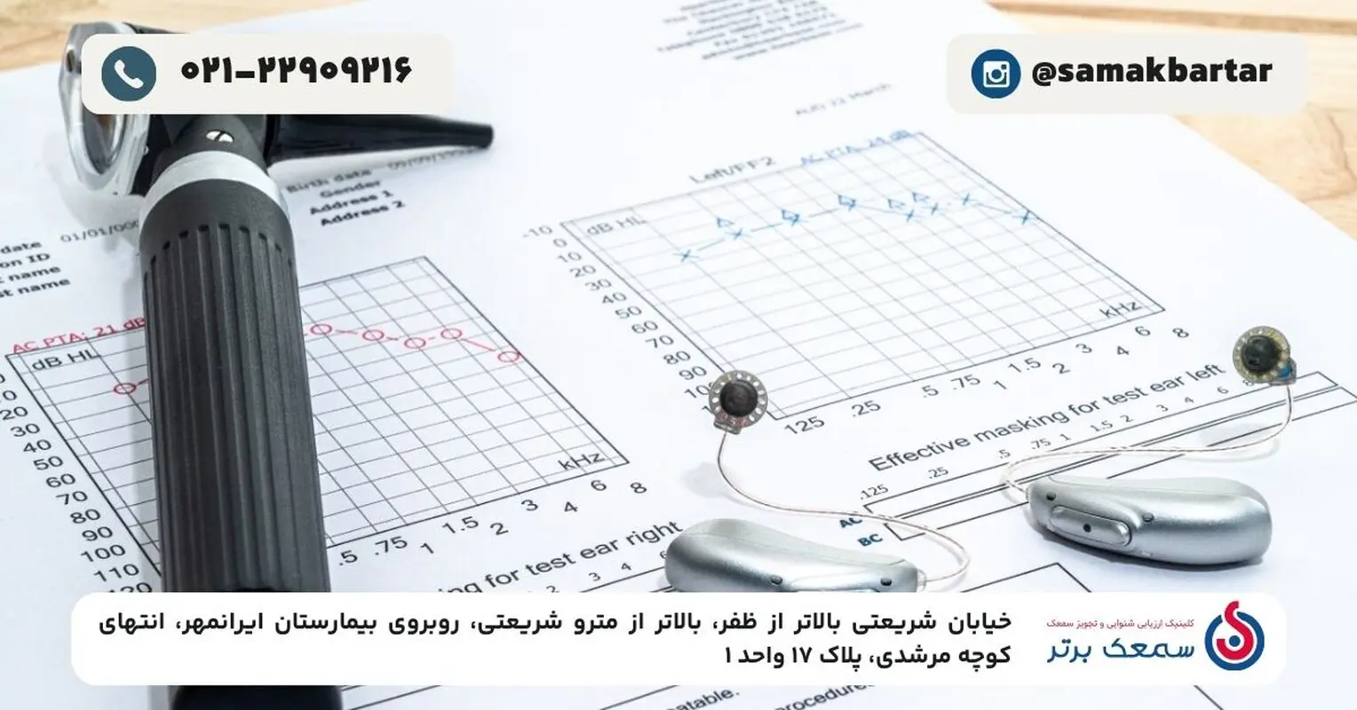 نمایندگی فروش سمعک در تهران؛ انتخابی مطمئن برای خرید و خدمات پس از فروش