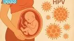زگیل تناسلی در  بارداری، خطرناک است؟ ۵ عارضه + روش درمان
