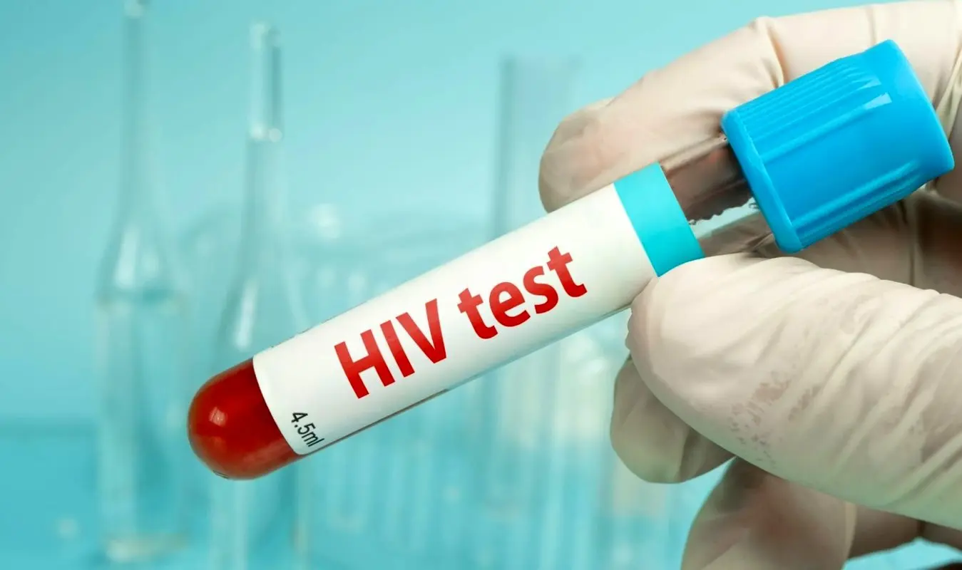 بیماری ایدز چیست؟ روش‌های انتقال و درمان HIV