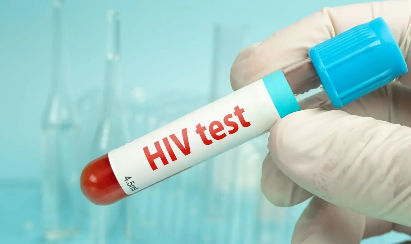 بیماری ایدز چیست؟ روش‌های انتقال و درمان HIV