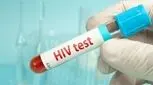 بیماری ایدز چیست؟ روش‌های انتقال و درمان HIV