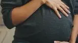 جلوگیری از ترک شکم در حاملگی چگونه است؟
