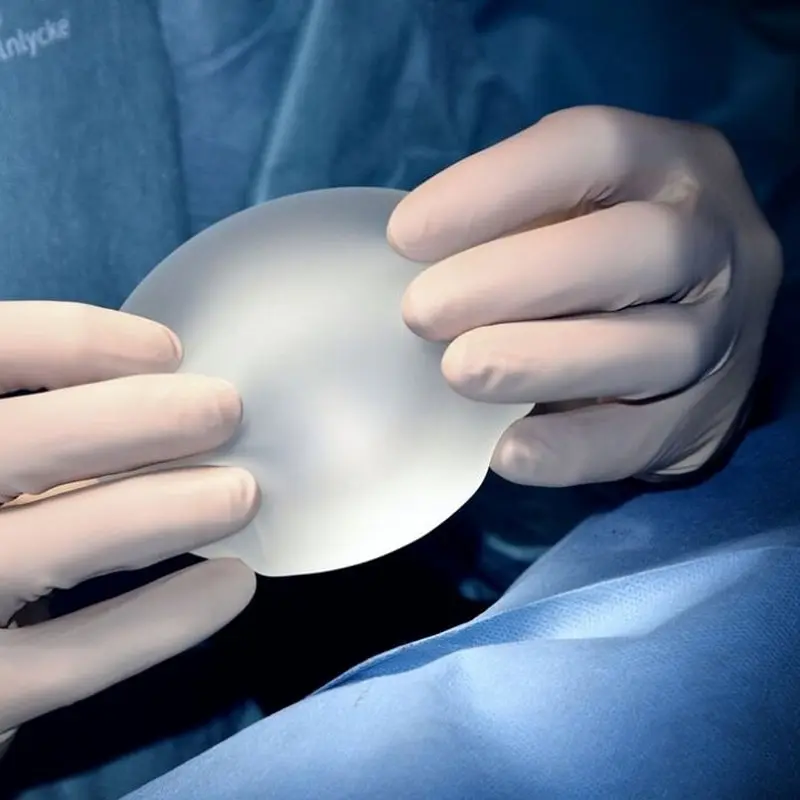 بهترین جراح پروتز سینه در تهران، نحوه انتخاب!