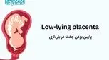پایین بودن جفت در بارداری ـ ۴ علامت آن و عوارض + راهکارهایی برای بالا رفتن جفت