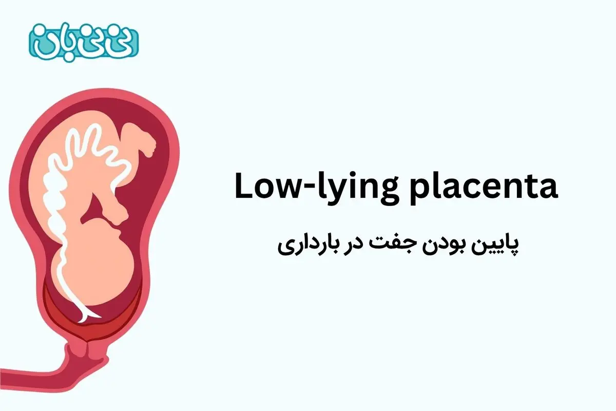 پایین بودن جفت در بارداری ـ ۴ علامت آن و عوارض + راهکارهایی برای بالا رفتن جفت