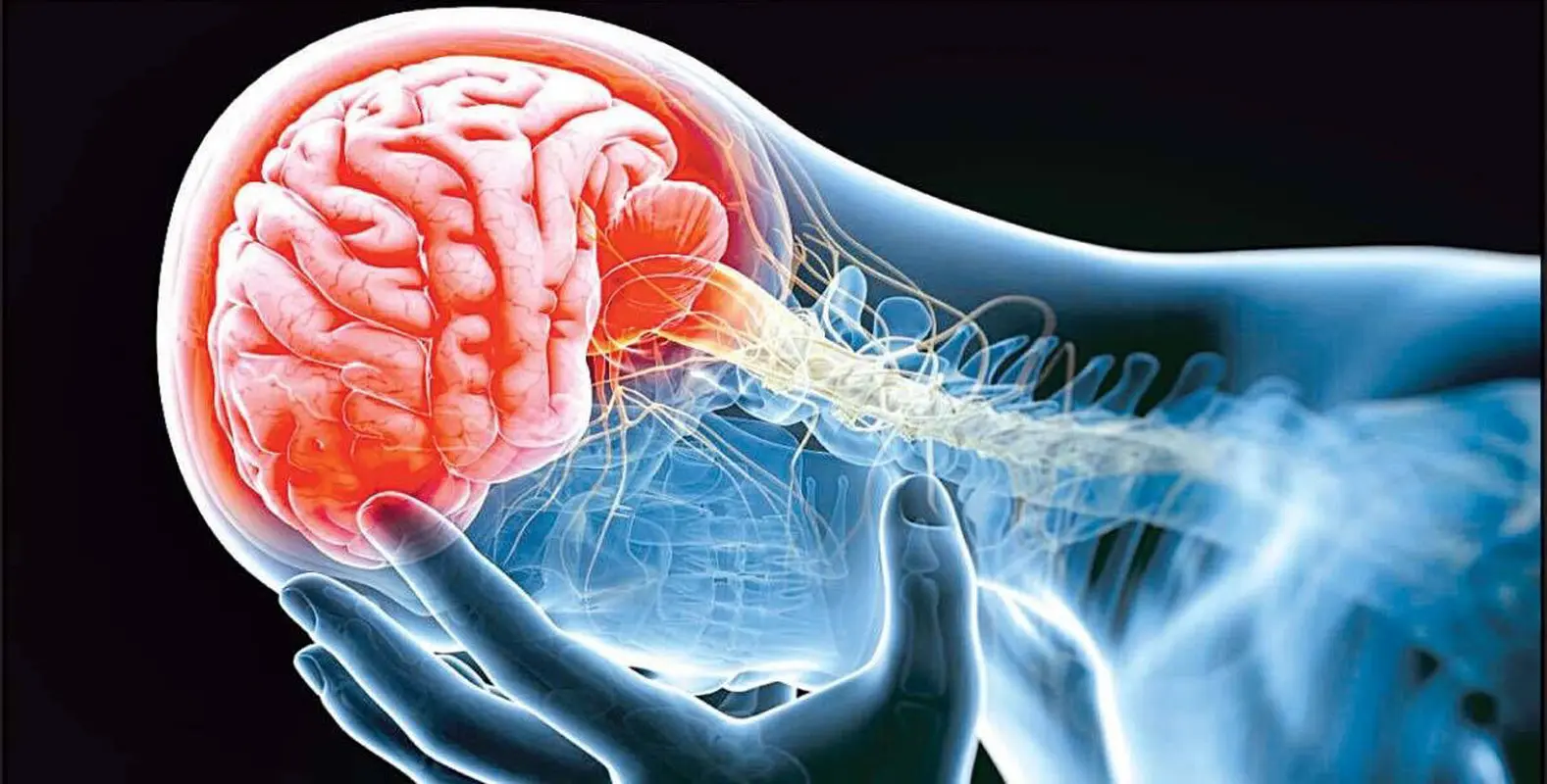 این دو عامل باعث سکته مغزی میشود