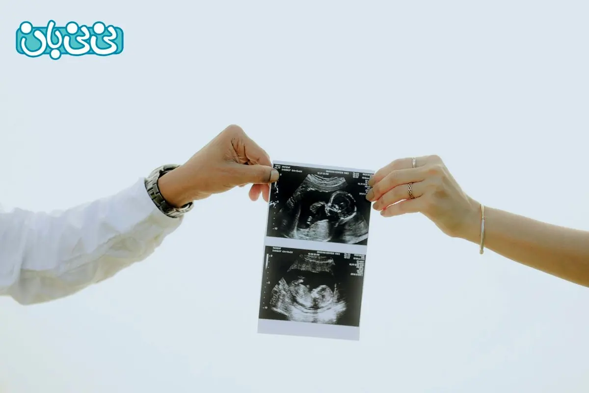 جنسیت جنین پسر زودتر مشخص می‌شود یا دختر؟