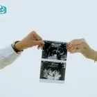 جنسیت جنین پسر زودتر مشخص می‌شود یا دختر؟