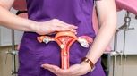 درمان تنبلی تخمدان در دختران مجرد بالای 35 سال؛ علائم و علت