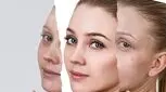 پانچ صورت برای درمان جای جوش و اسکار آکنه