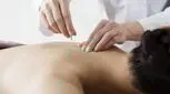از طب سوزنی و خواصش چه می‌دانید؟