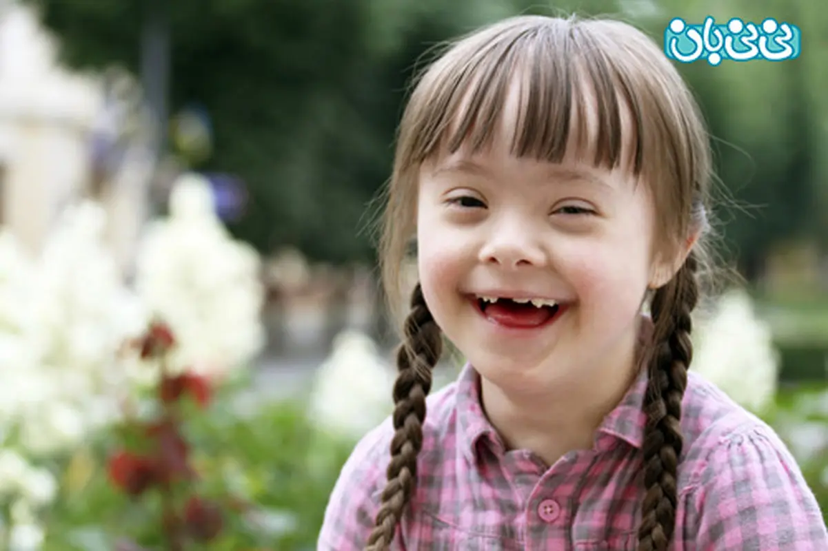 سلامت جنسی مبتلایان سندرم داون (2)