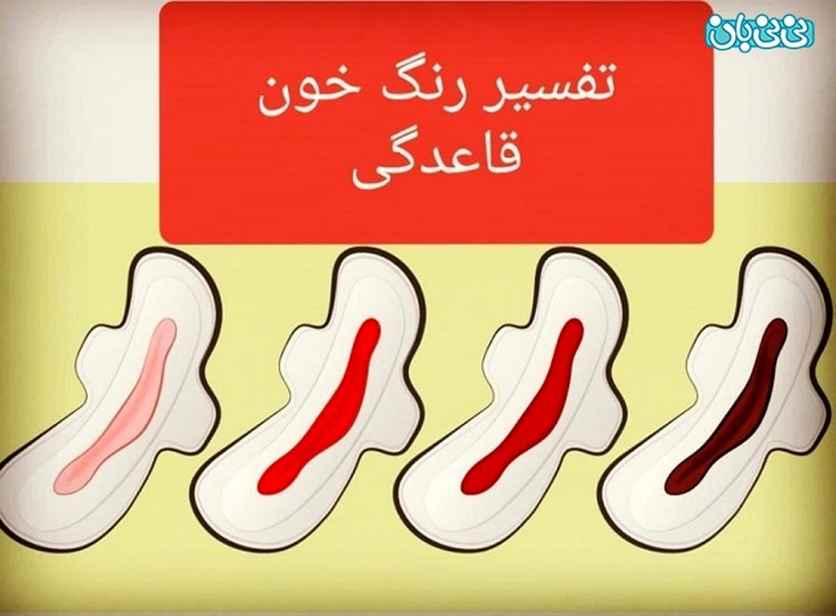 بوی بد خون قاعدگی، نشانه بیماری