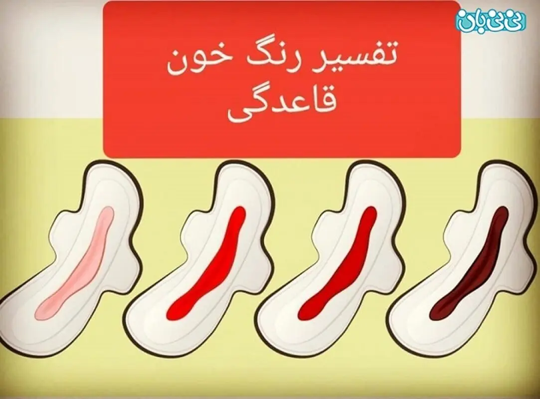 بوی بد خون قاعدگی، نشانه بیماری