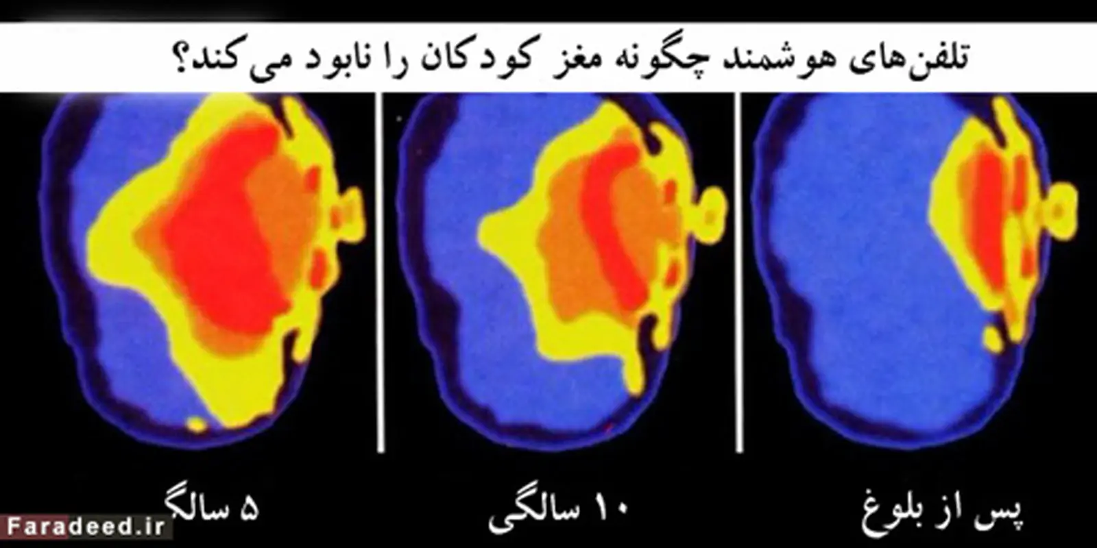 عوارض تبلت برای کودکان، چیست؟