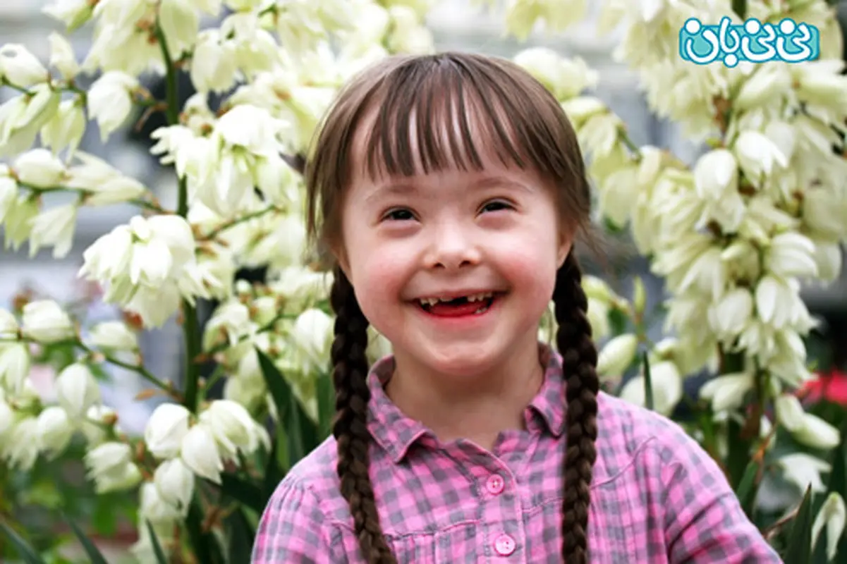 سندروم داون  و حقایقی درباره آن (1)