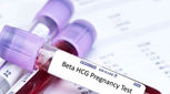 بهترین زمان آزمایش خون بارداری!