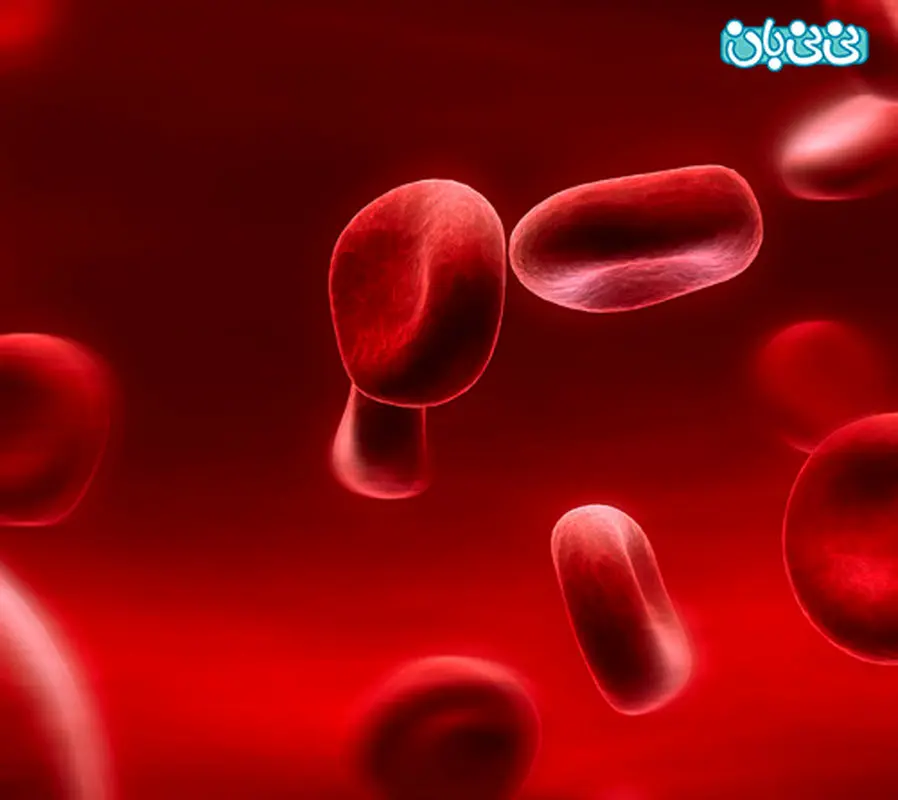 نشانه های کم خونی در زنان، چیست؟