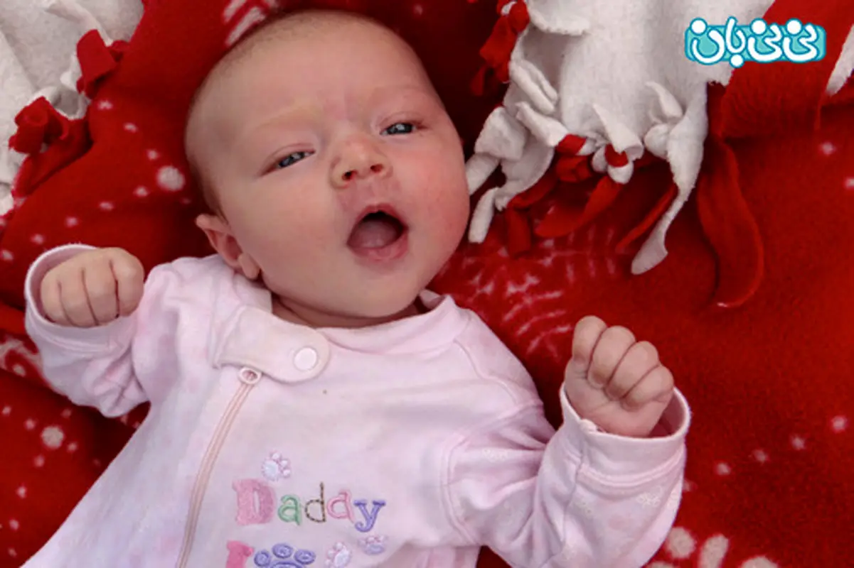 کجی گردن در نوزادان، دلیلش چیست؟