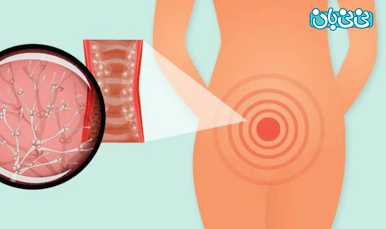 برطرف کردن عفونت با پونه و نعنا