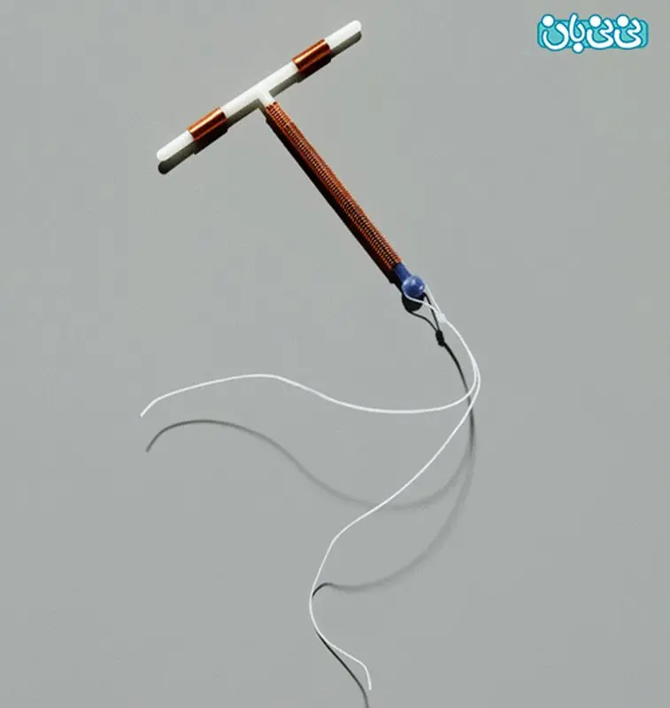 آی یو دی چطور از بارداری پیشگیری می کند؟