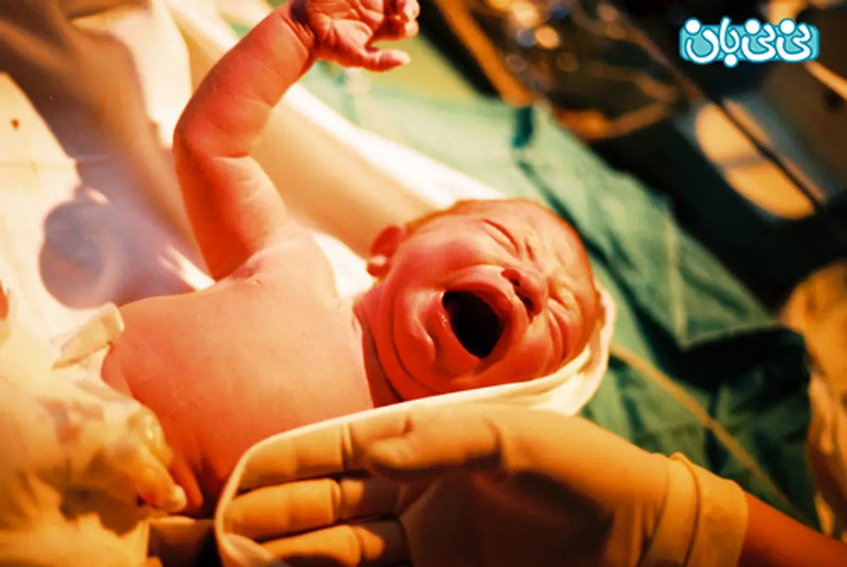 آمار زایمان طبیعی و سزارین در ایران