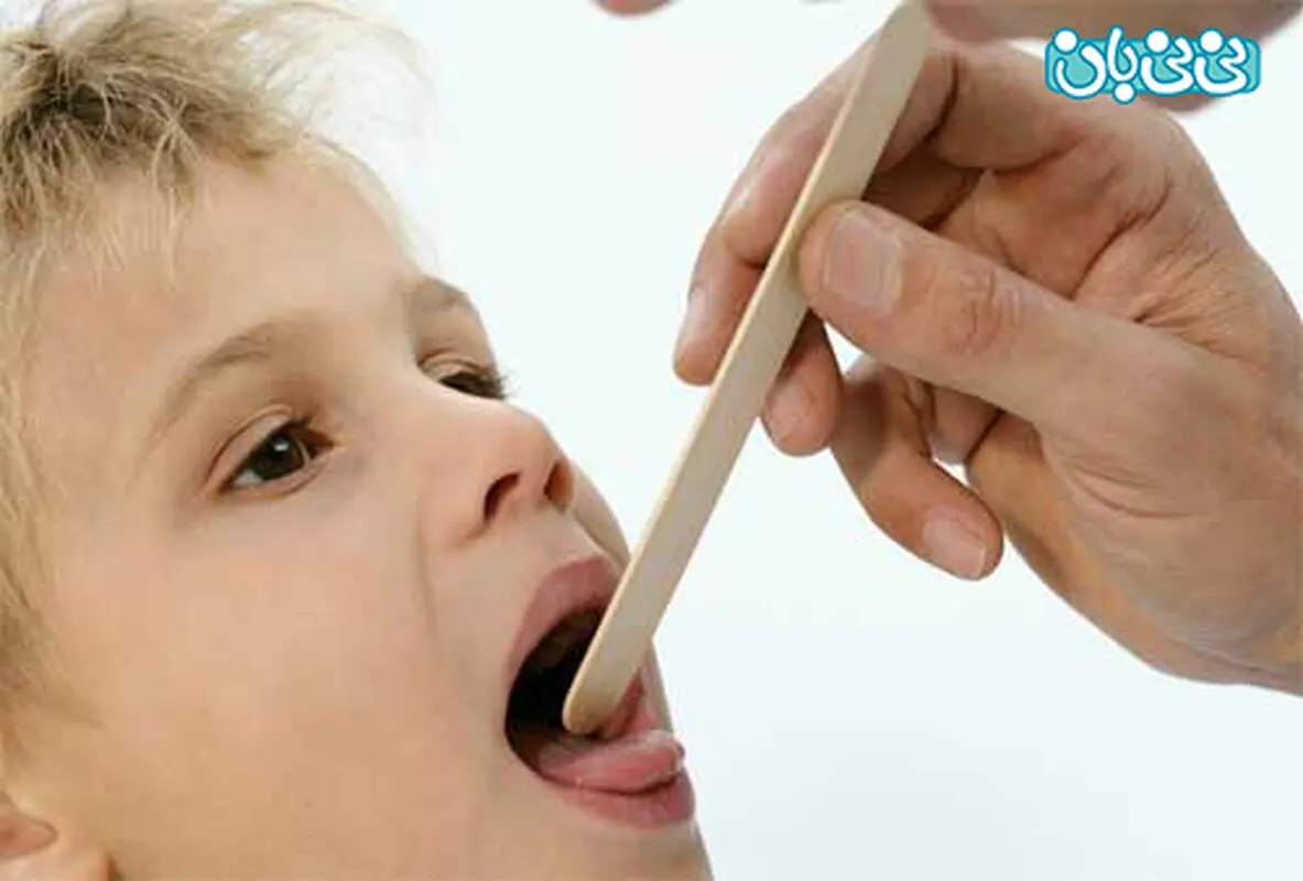 لوزه سوم کودکان، راه‌های تشخیص