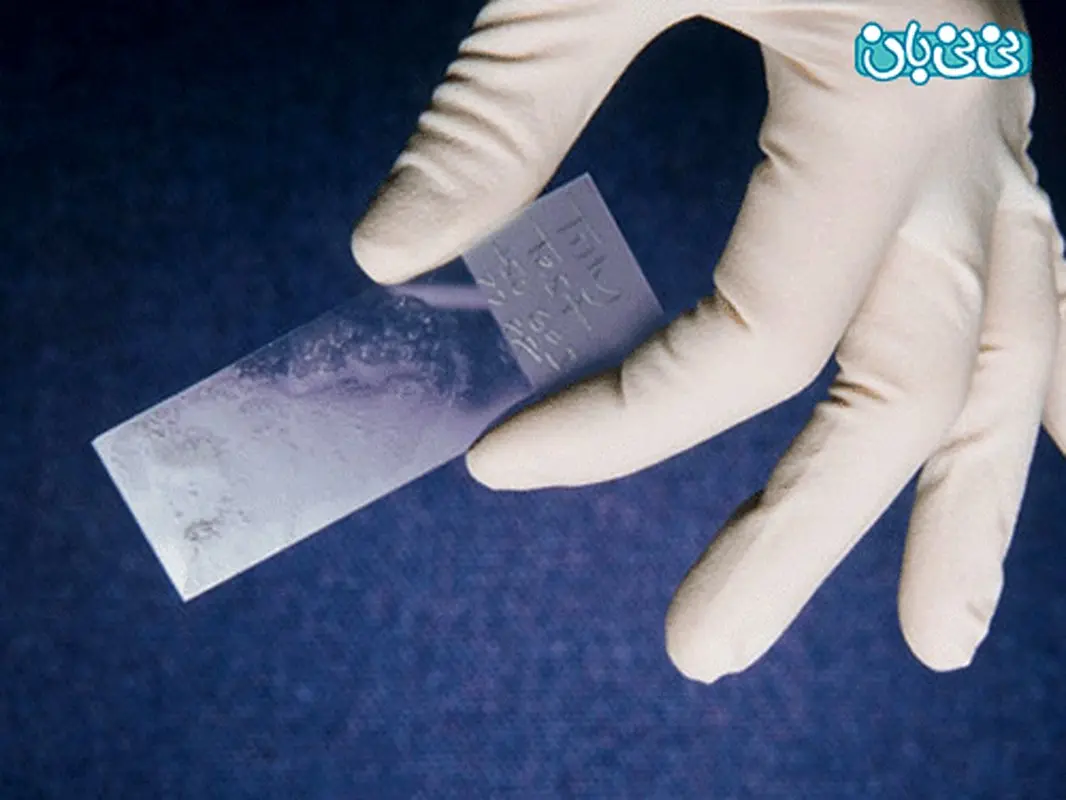 پاپ اسمیر قبل از بارداری