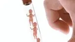ناباروری با علت نامعلوم