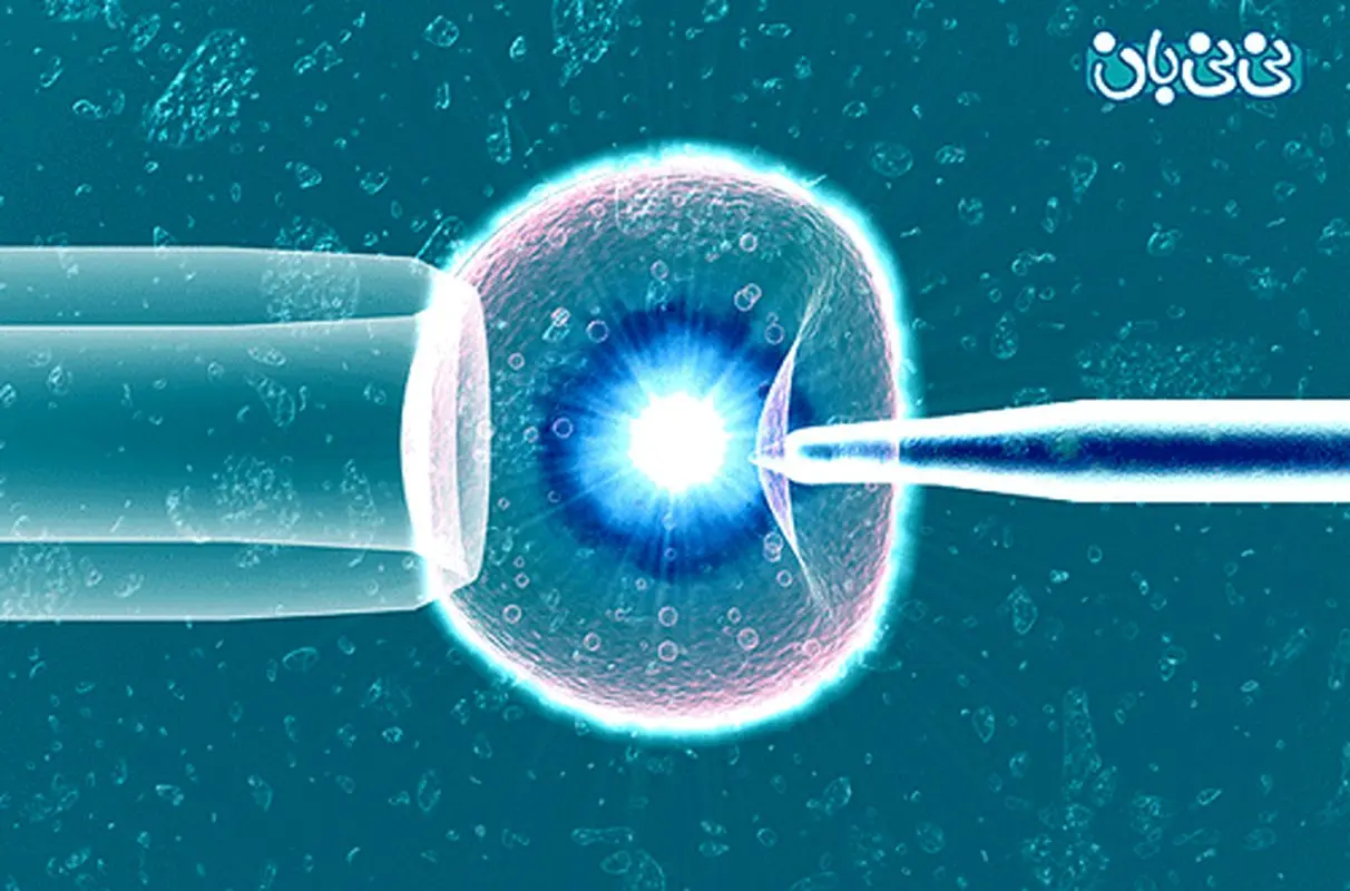 تکنولوژی های کمک باروری، کدامند؟