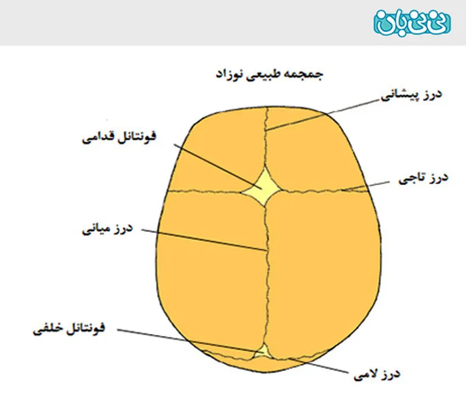 پیشانی نوزاد را با پارچه ببندیم؟