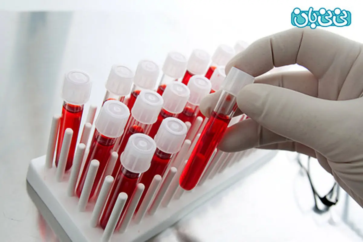 آزمایشات لازم پیش از بارداری، چه اهمیتی دارد؟
